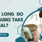 How Long Do Cut Gums Take To Heal?